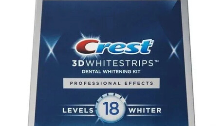 The Advantages of Crest 3D White Over Professional Whitening Treatment